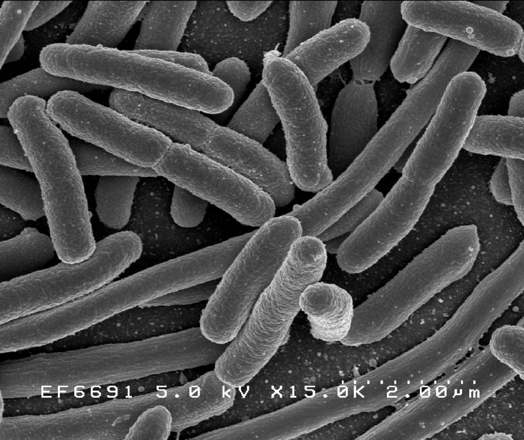 E.Coli