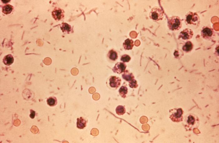 Shigella