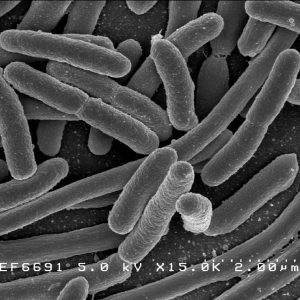 E.Coli