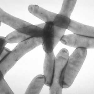 Legionella_pneumophila_01 Legionella