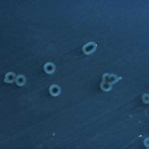 Salmonella_enterica_serovar_typhimurium_01 Salmonella